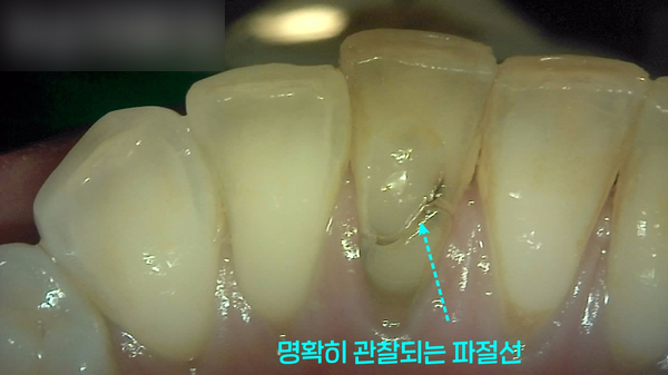 Treatment case image 1