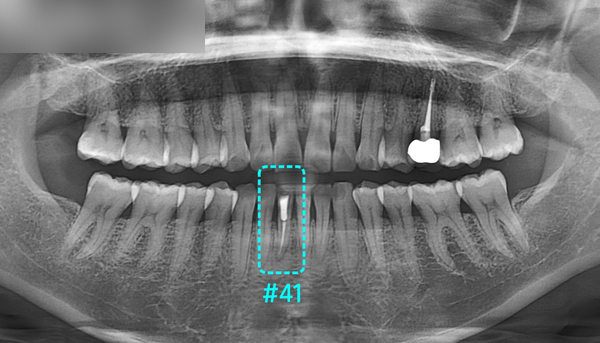 Treatment case image 2