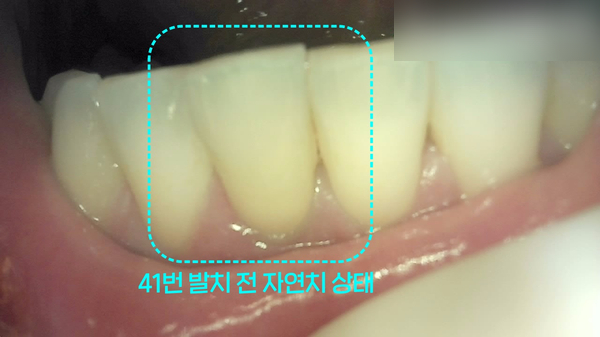 Treatment case image 3