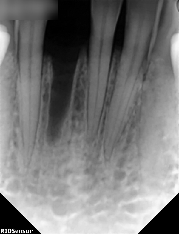 Treatment case image 4