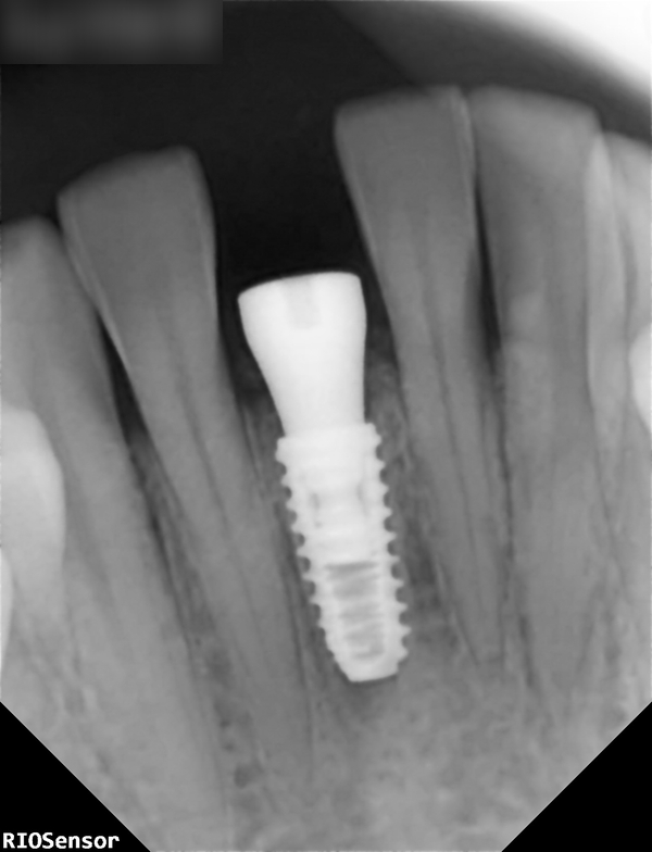 Treatment case image 9