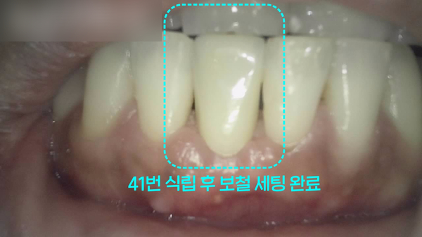 Treatment case image 11
