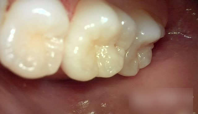 Treatment case image 1