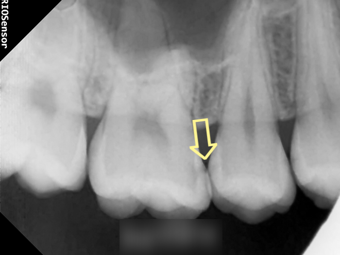 Treatment case image 2