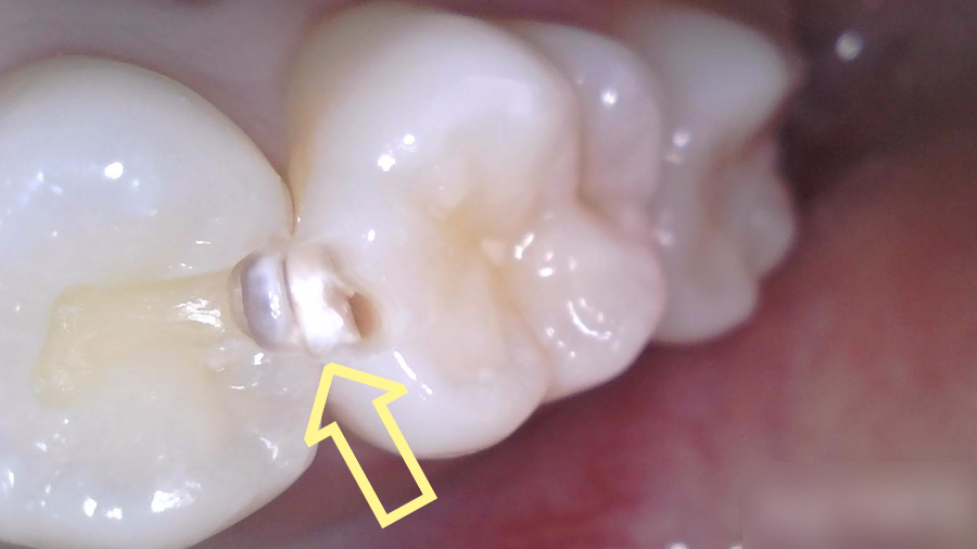 Treatment case image 3