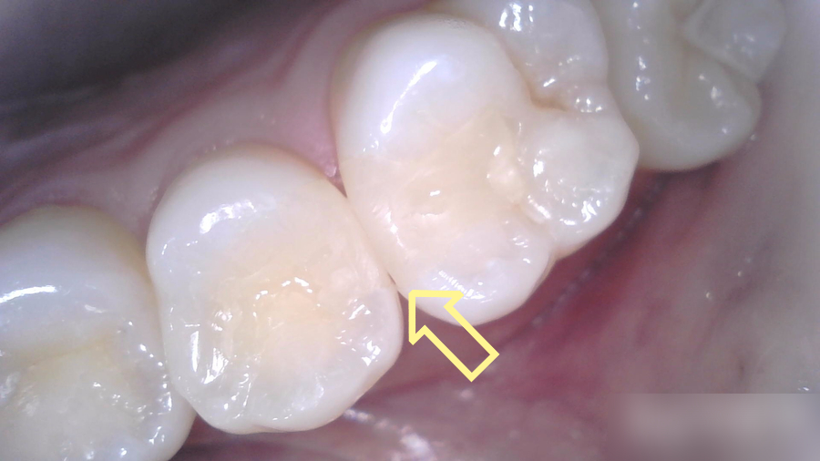Treatment case image 6