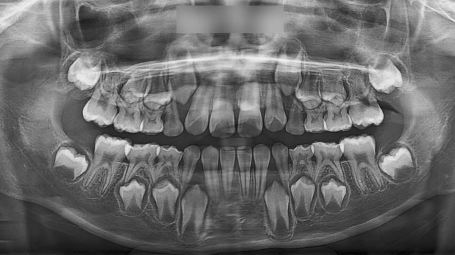 Treatment case image 1