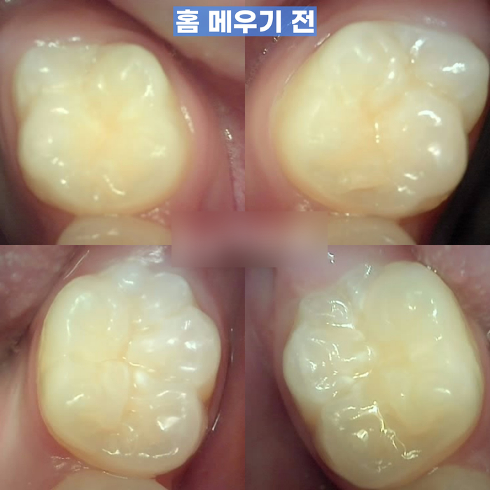 Treatment case image 2