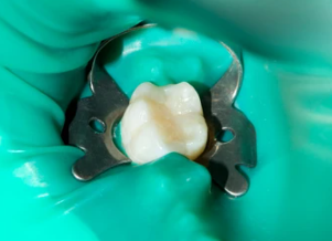 Treatment case image 5