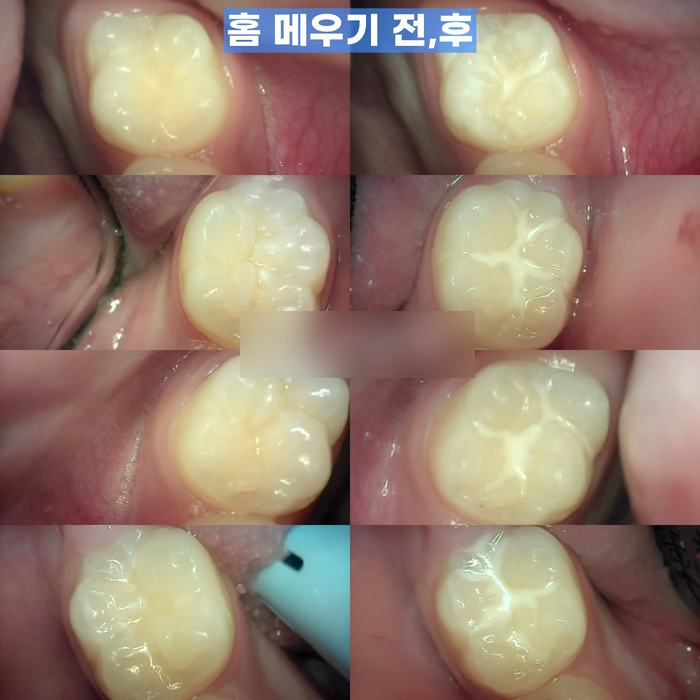 Treatment case image 9