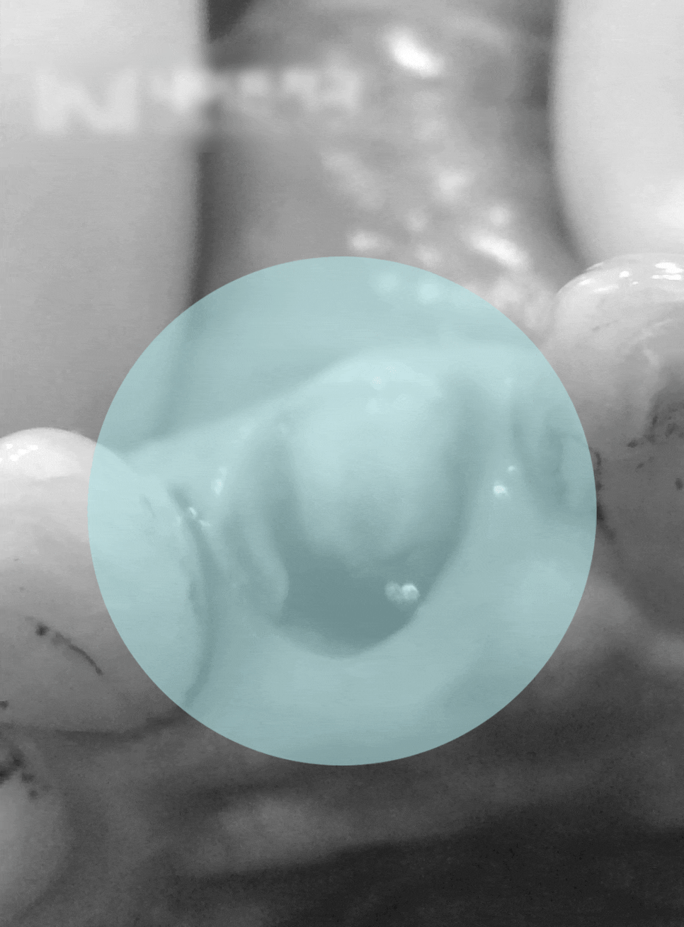 Treatment case image 1