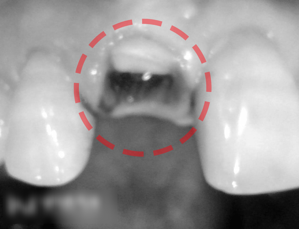 Treatment case image 3