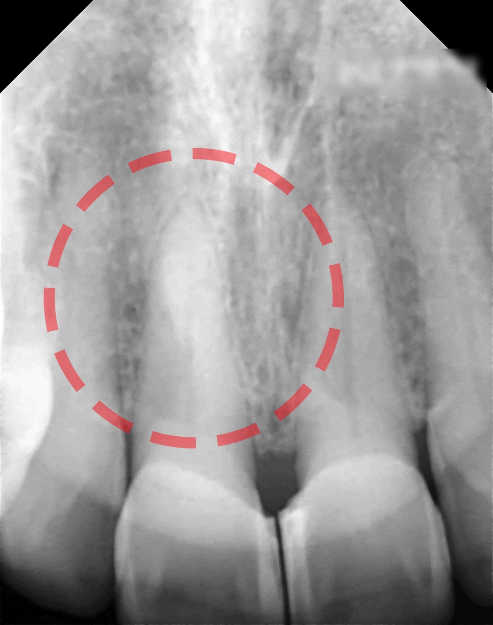 Treatment case image 4