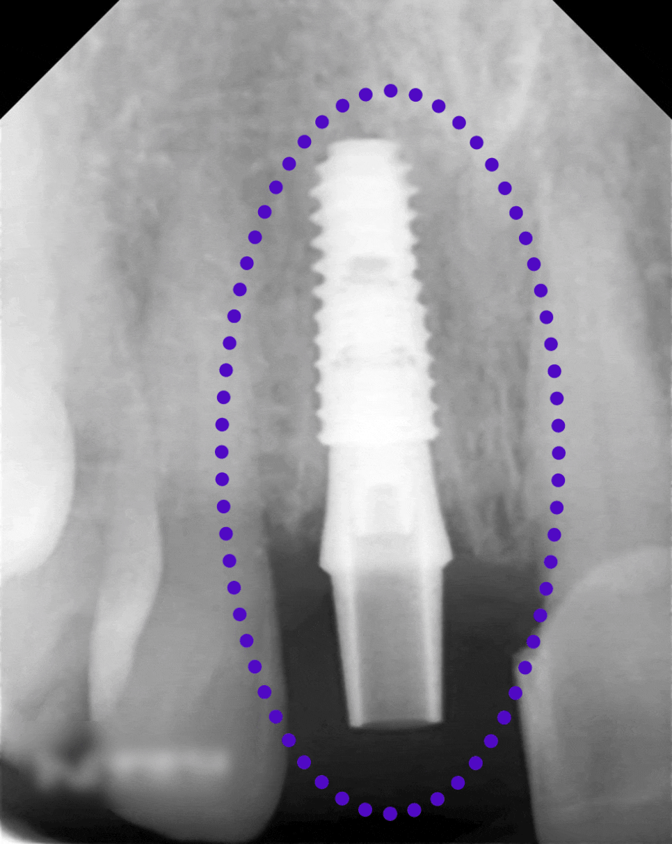 Treatment case image 5