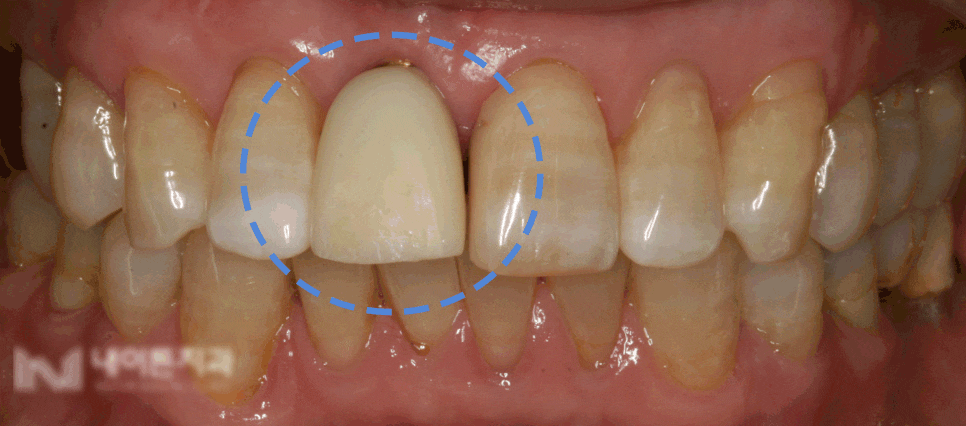 Treatment case image 6