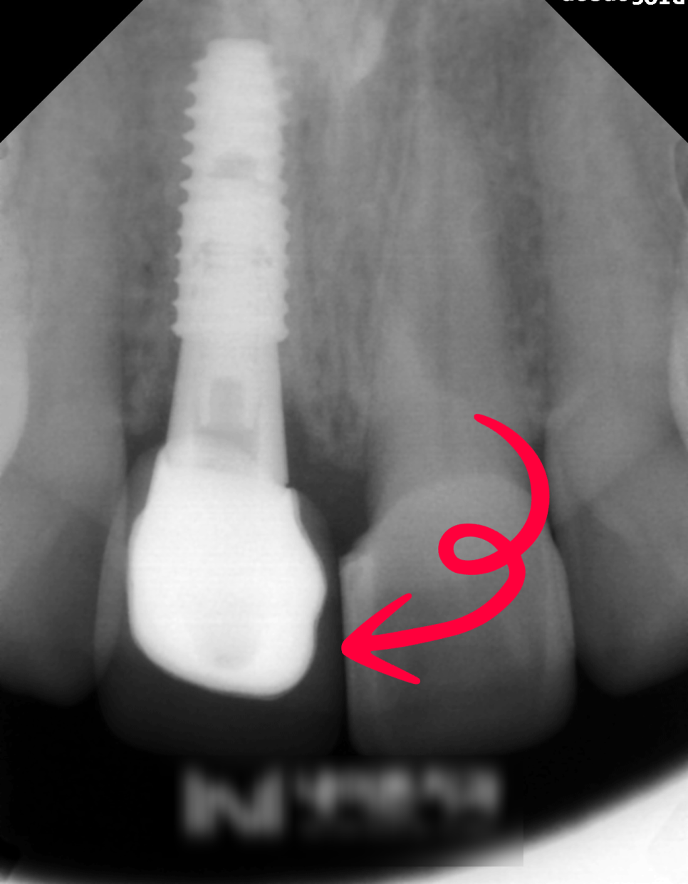 Treatment case image 7
