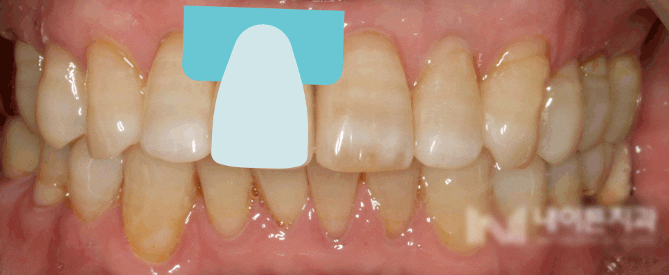 Treatment case image 8