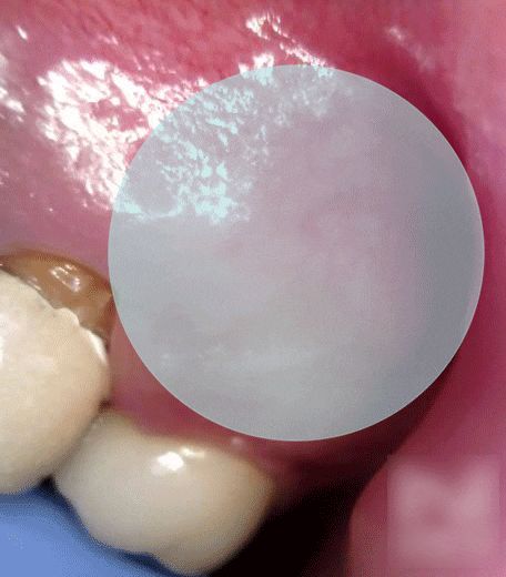 Treatment case image 1