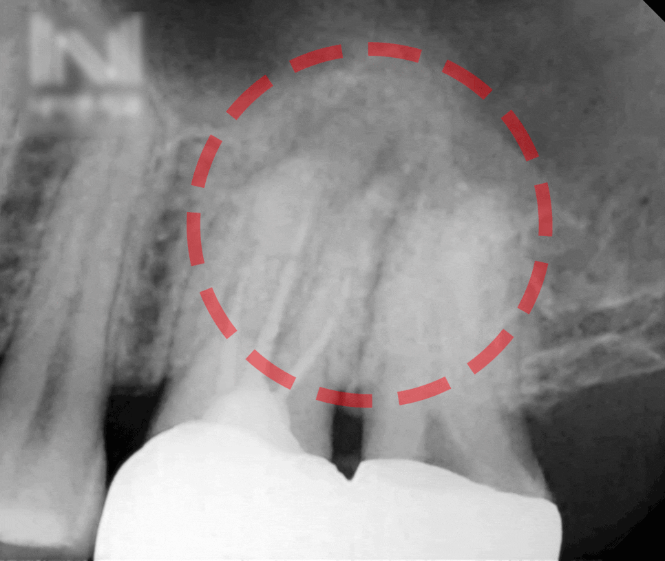 Treatment case image 2