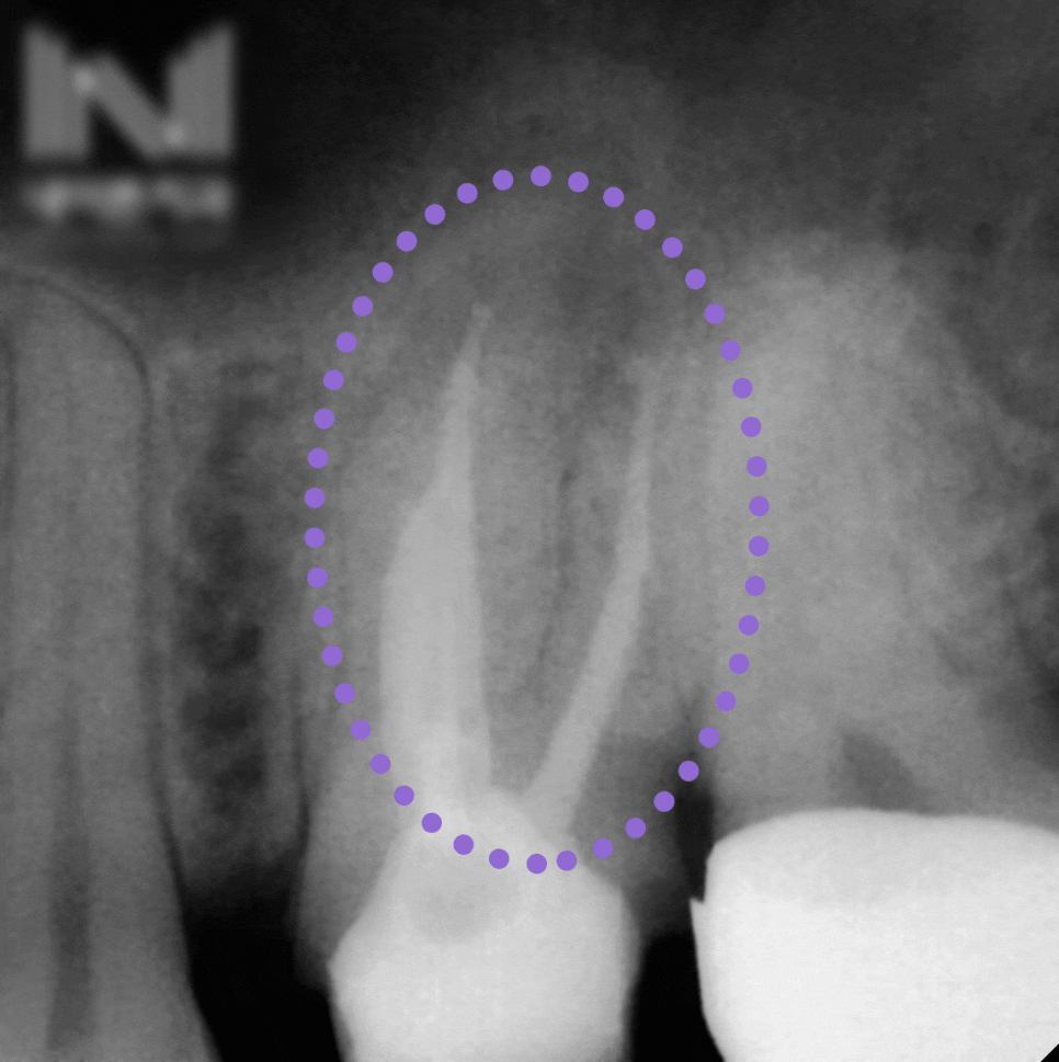 Treatment case image 6