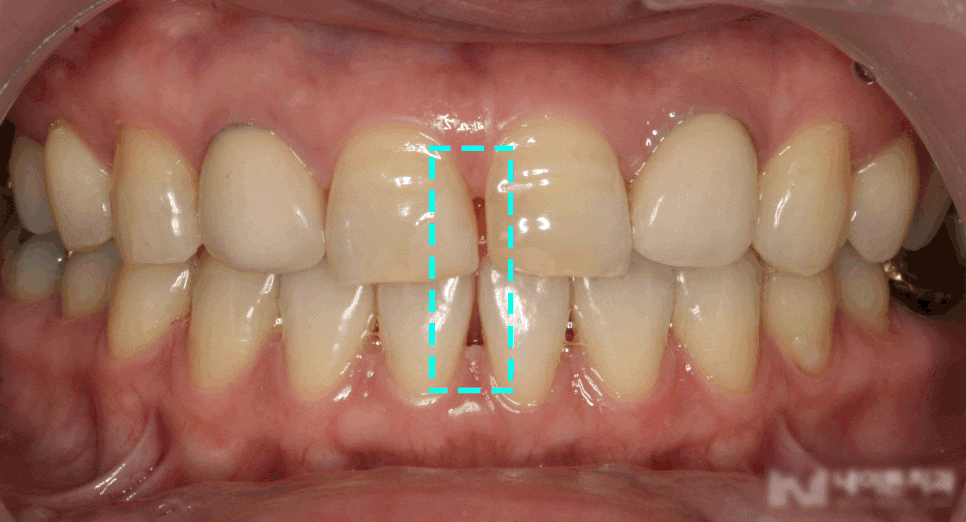 Treatment case image 1