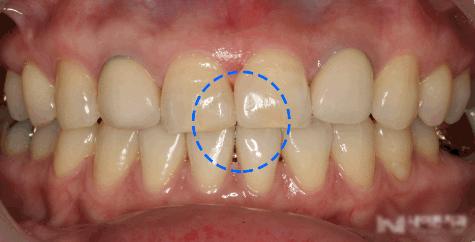 Treatment case image 3