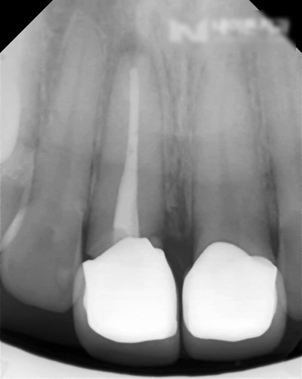 Treatment case image 1