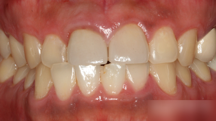 Treatment case image 2