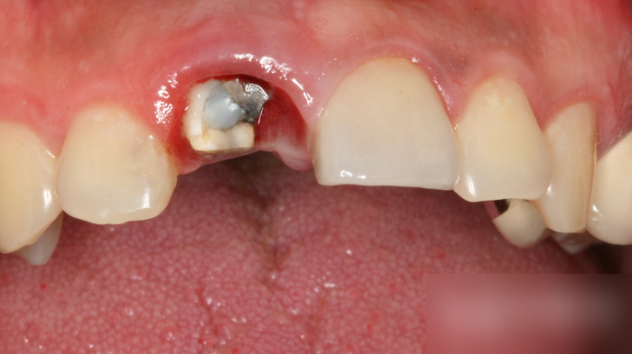 Treatment case image 5