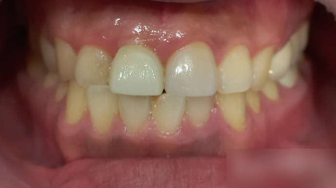 Treatment case image 6