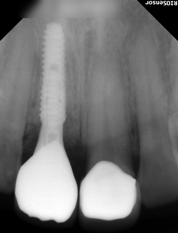 Treatment case image 7