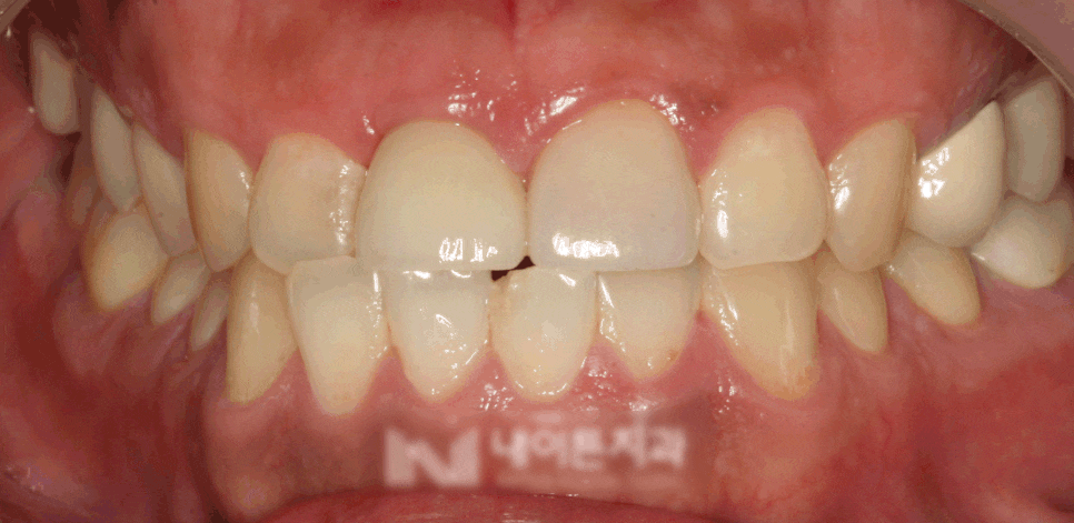 Treatment case image 8