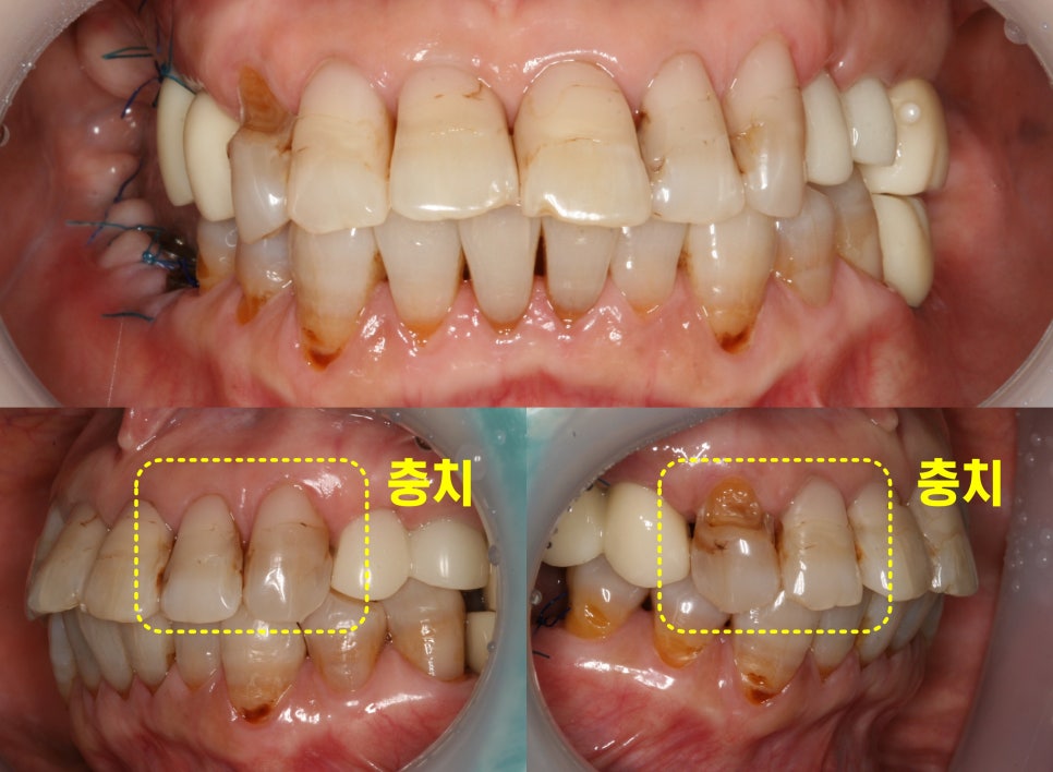 Treatment case image 1