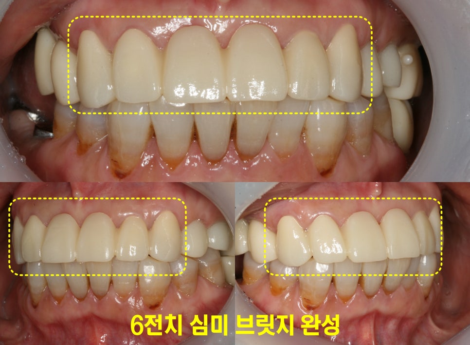 Treatment case image 3