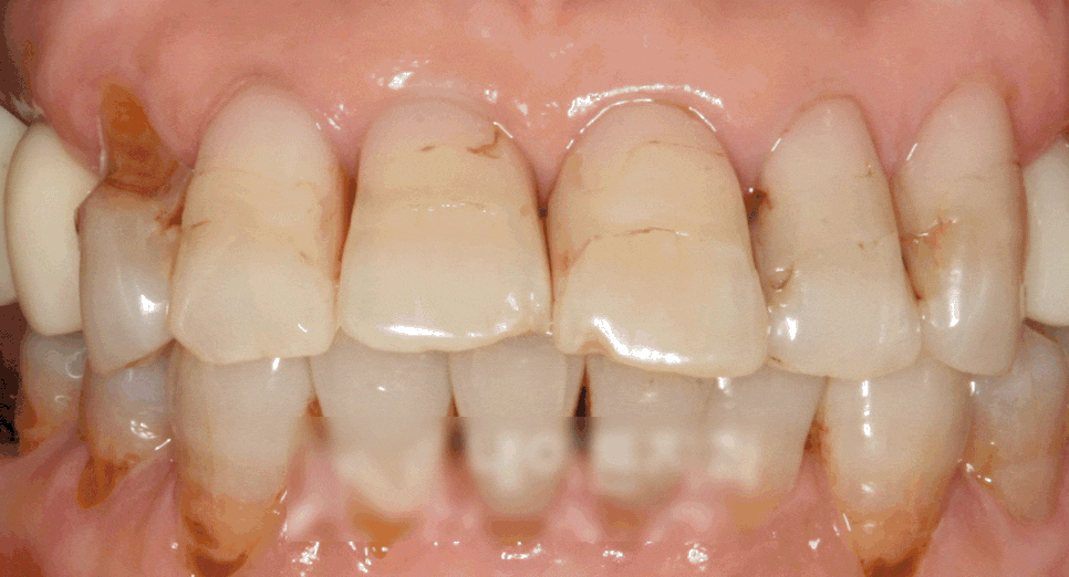 Treatment case image 4