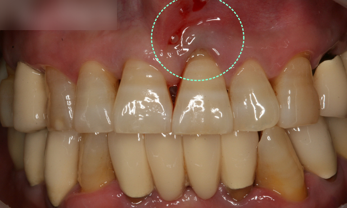 Treatment case image 1