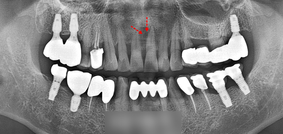 Treatment case image 2