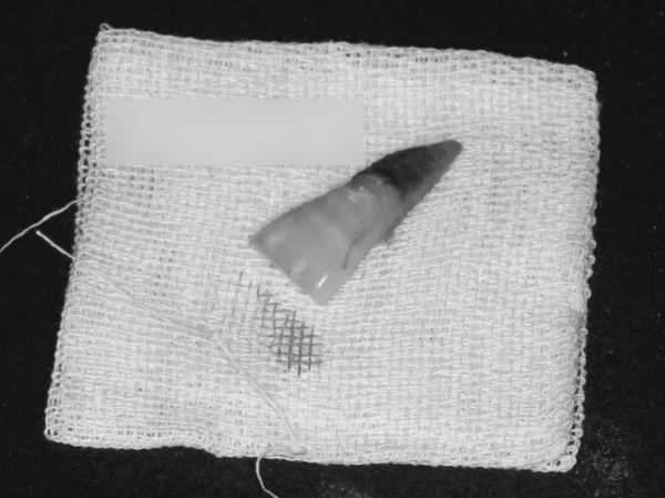 Treatment case image 5