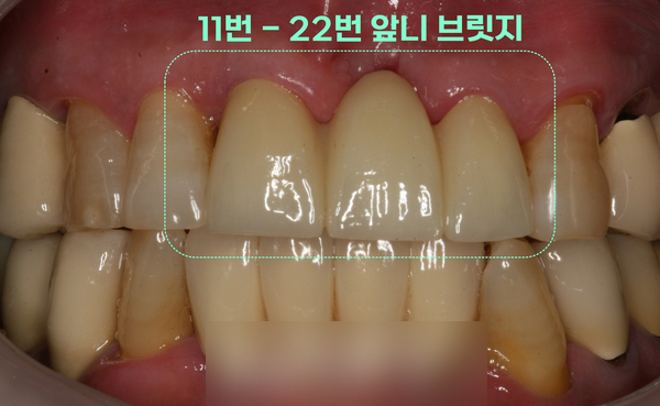 Treatment case image 7
