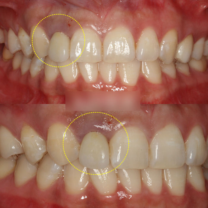 Treatment case image 1