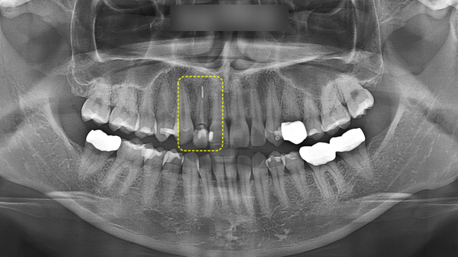 Treatment case image 2