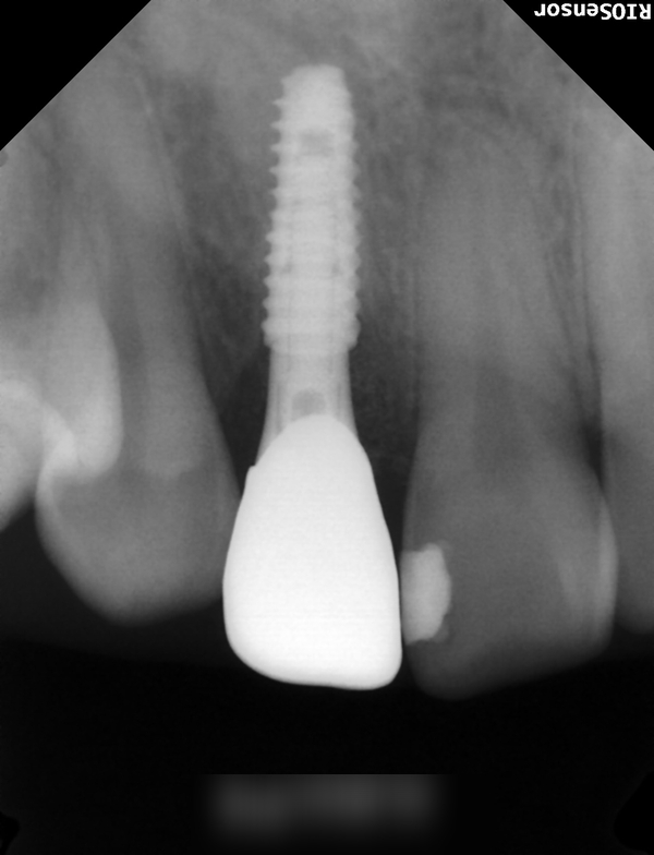 Treatment case image 5