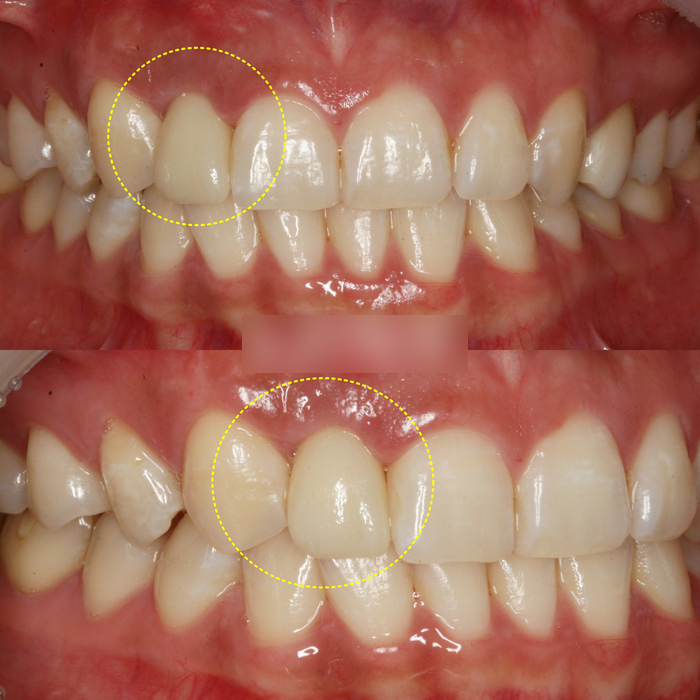 Treatment case image 6