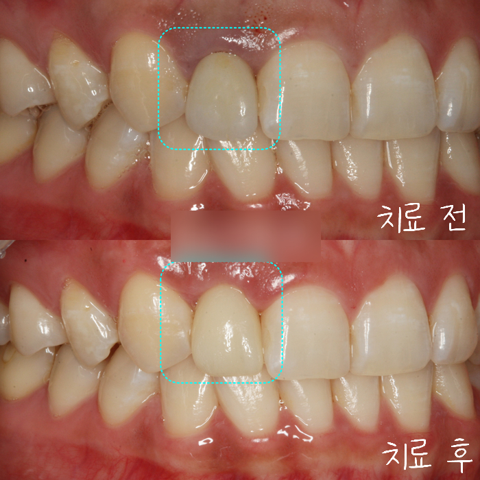 Treatment case image 9