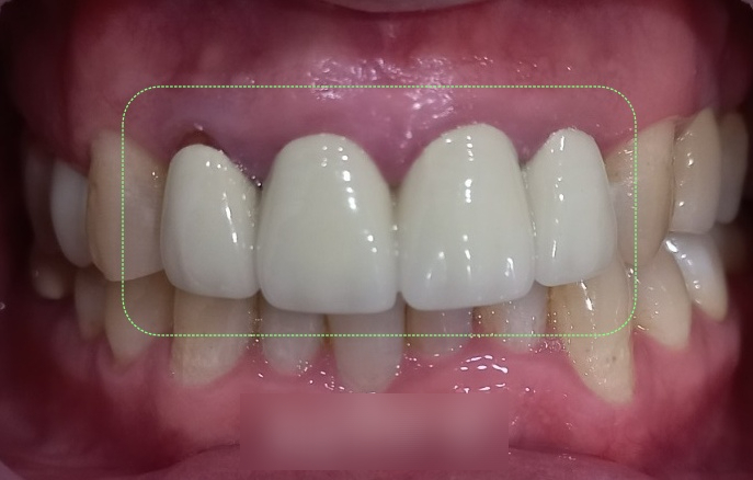 Treatment case image 1