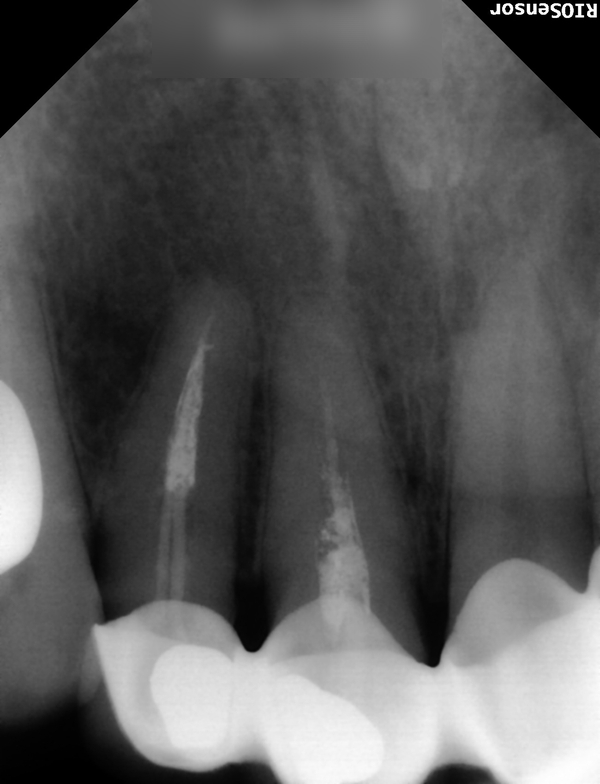 Treatment case image 3