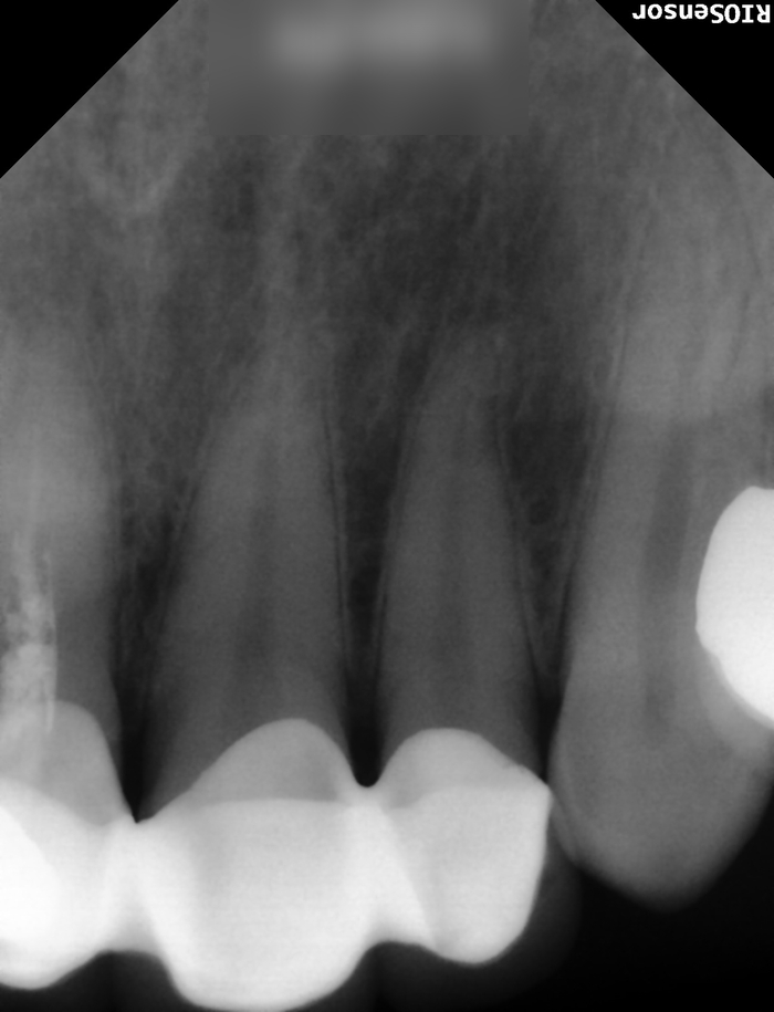 Treatment case image 4