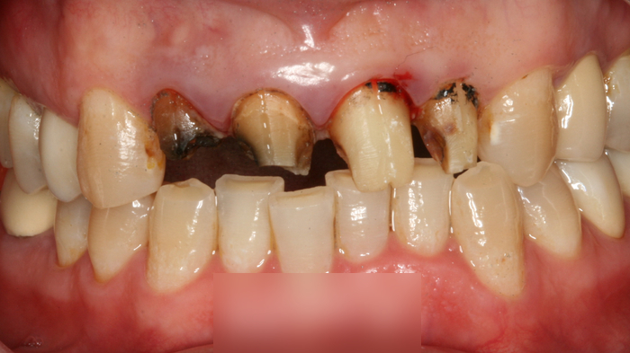 Treatment case image 5
