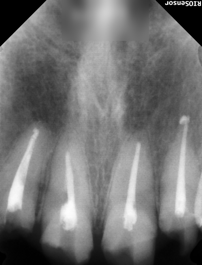 Treatment case image 9