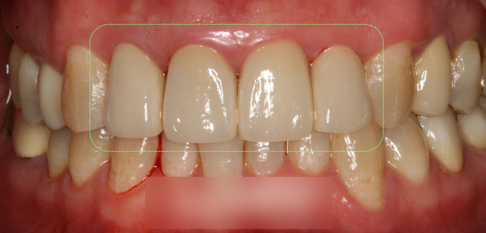 Treatment case image 10